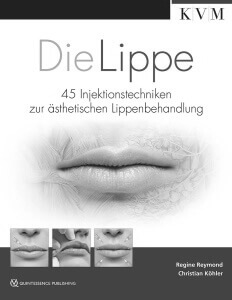 Die Lippe, Buch von Christian Köhler, prevention-center Zürich / Zug