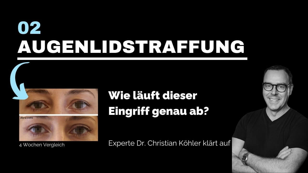 Augenlidstraffung, prevention-center für Schönheitschirurgie in Zürich & Zug
