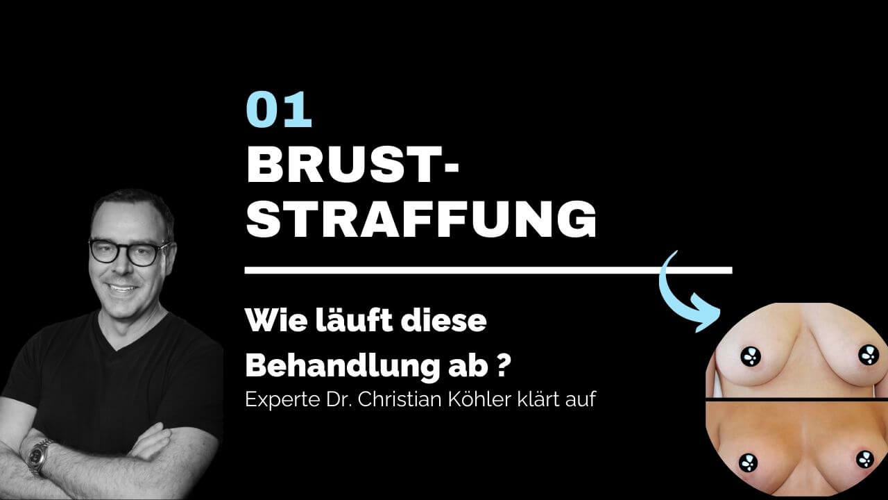 Bruststraffung, prevention-center für Schönheitschirurgie in Zürich & Zug