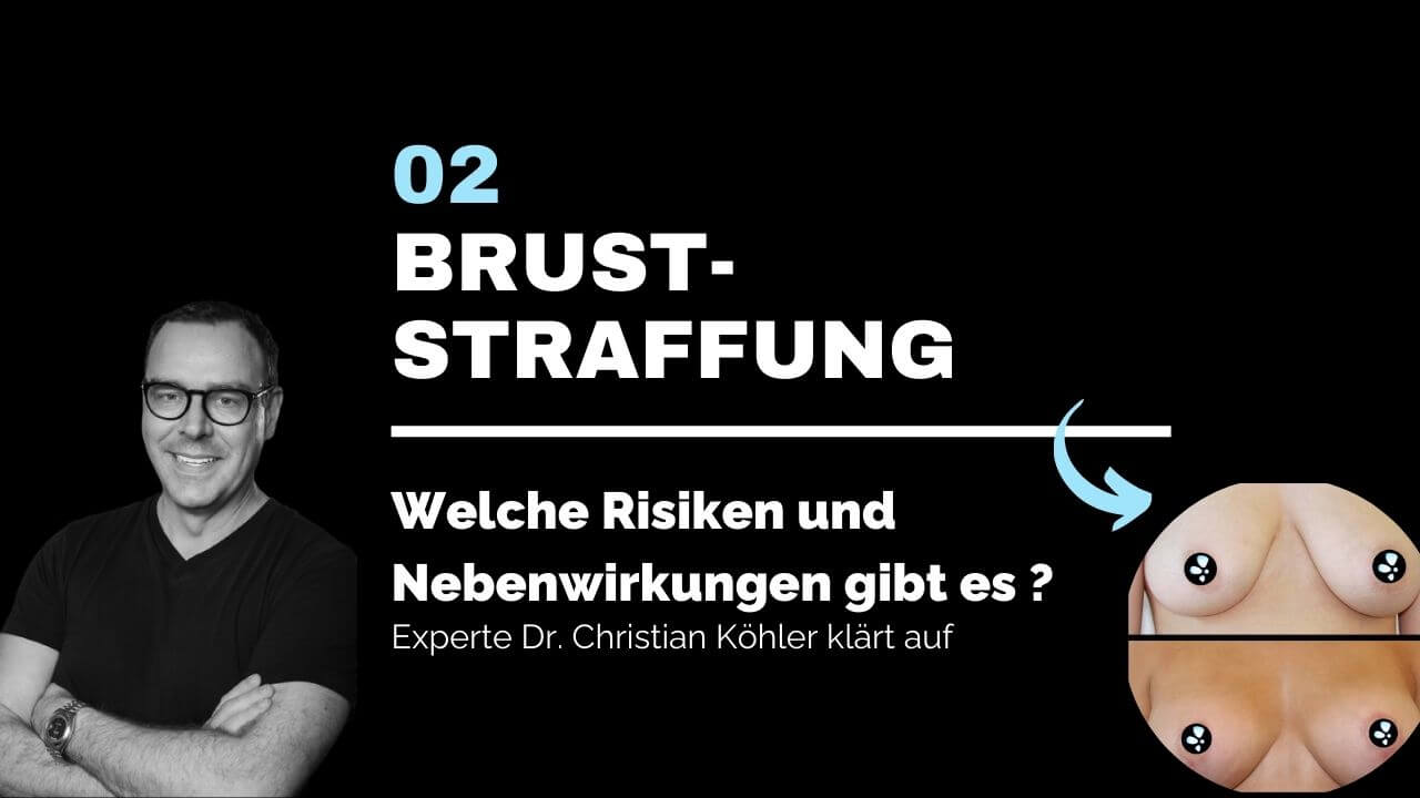Bruststraffung, prevention-center für Schönheitschirurgie in Zürich & Zug